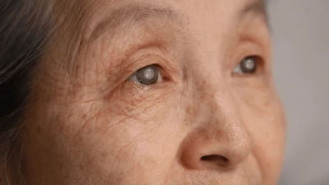 Mắt bị đục thủy tinh thể do đâu?