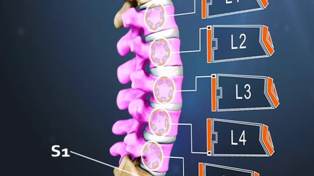 Gãy đốt sống lưng L2 có nguy hiểm?