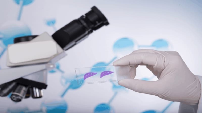 khi nào cần sinh thiết đại tràng