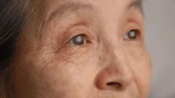 Nên kiêng gì sau khi mổ đục thủy tinh thể?