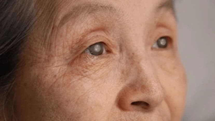 Nên kiêng gì sau khi mổ đục thủy tinh thể?