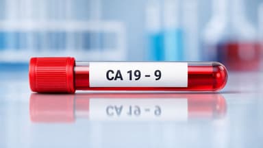 Marker ung thư đường mật CA 19 – 9 có ý nghĩa như thế nào trong chẩn đoán?