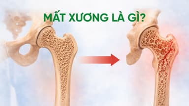 Mất xương là gì? Quá trình mất xương theo tuổi diễn ra như thế nào?