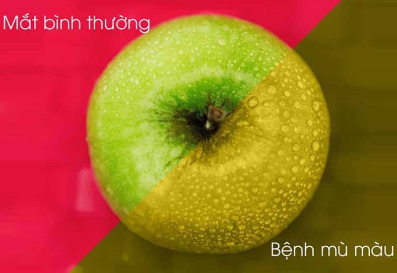 mù màu có chữa được không