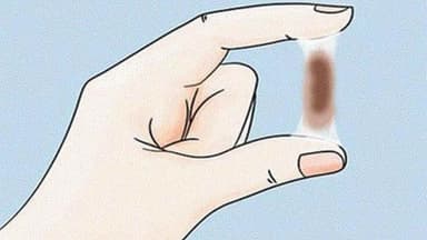 Đến ngày rụng trứng ra chất nhầy màu nâu có đáng lo?