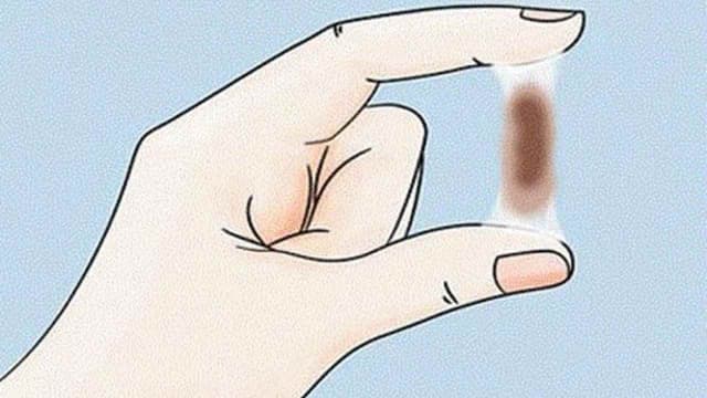 Đến ngày rụng trứng ra chất nhầy màu nâu có đáng lo?