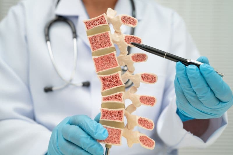 loãng xương ở nam giới