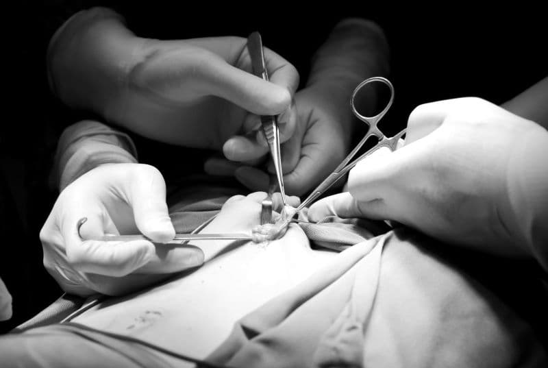 cắt tinh hoàn trong ung thư tiền liệt tuyến