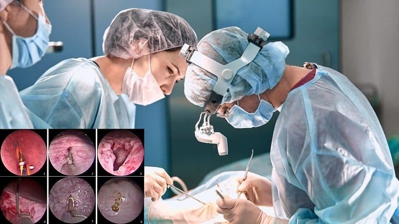 xuất huyết bàng quang là gì