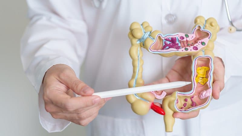 bị polyp đại tràng có đau bụng không