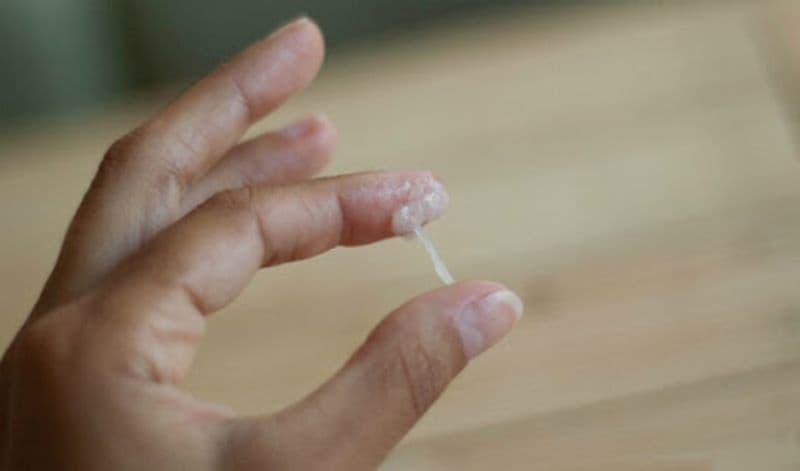 khí hư khi rụng trứng