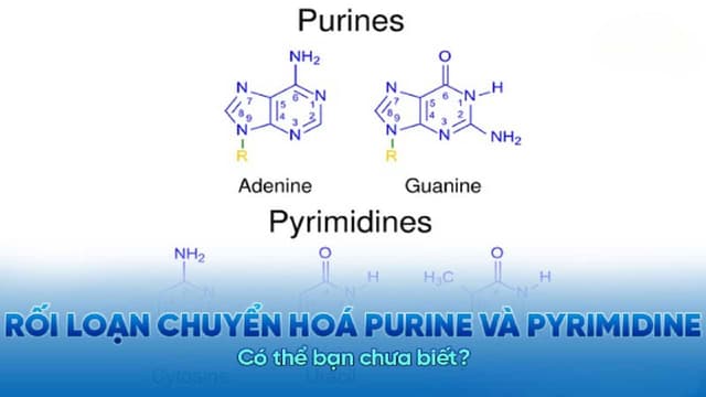 Rối loạn chuyển hoá purine và pyrimidine là gì?