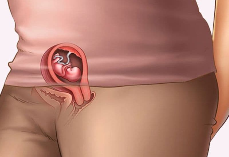 thai nhi 10 tuần tuổi phát triển như thế nào