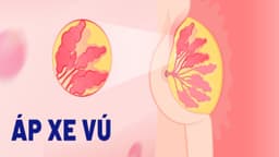 Các thuốc kháng sinh trị áp xe vú hiệu quả