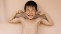 Trẻ bị còi xương là thiếu chất gì?