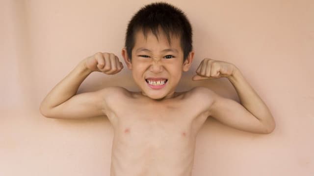 Trẻ bị còi xương là thiếu chất gì?