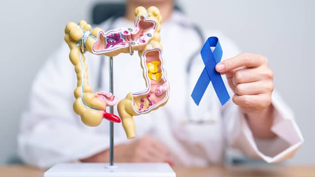 Các triệu chứng của polyp đại tràng lành tính