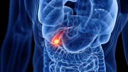 Ung thư đường mật có di truyền không?