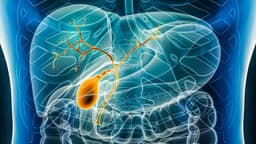 Đặc điểm ung thư đường mật giai đoạn 4