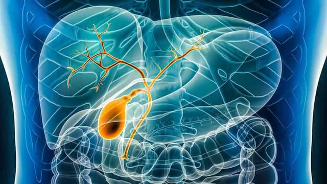 Đặc điểm ung thư đường mật giai đoạn 4