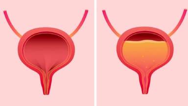 Uống nước bao lâu thì xuống bàng quang?