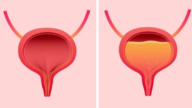 Uống nước bao lâu thì xuống bàng quang?