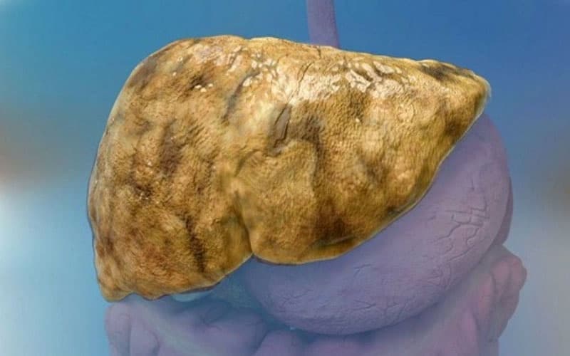 uống omega 3 có làm tăng men gan không