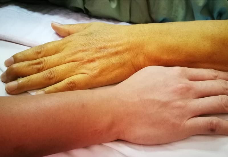 ung thư đường mật trong gan