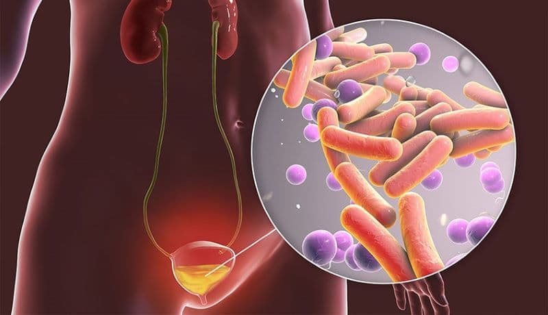 viêm bàng quang uống lá gì