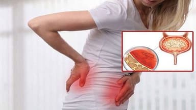 Viêm bàng quang xuất huyết ở nữ có nguy hiểm?