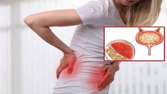 Viêm bàng quang xuất huyết ở nữ có nguy hiểm?