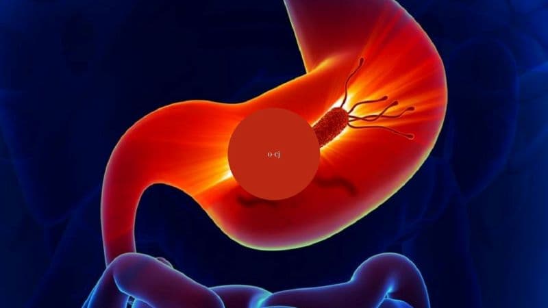 viêm teo niêm mạc dạ dày Hp âm tính