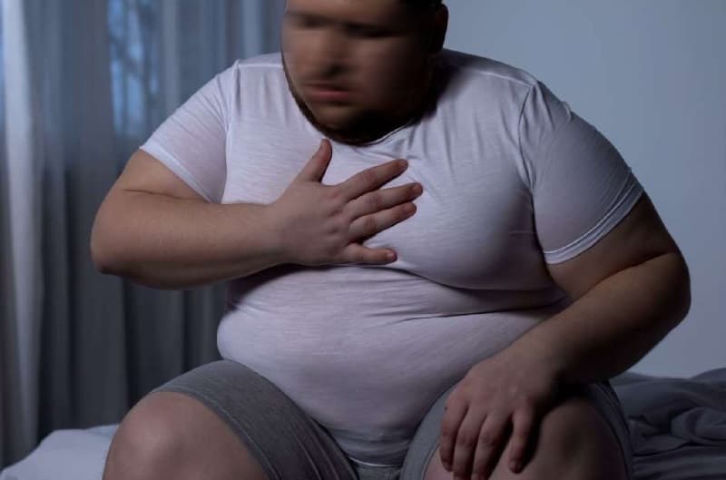 béo phì có gây đột quỵ không