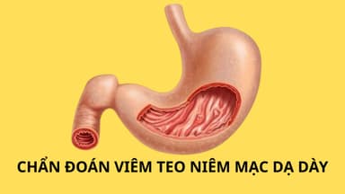 Cách chẩn đoán viêm teo niêm mạc dạ dày chi tiết từ A đến Z