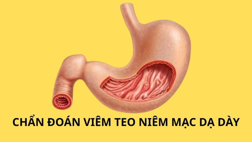 Cách chẩn đoán viêm teo niêm mạc dạ dày chi tiết từ A đến Z