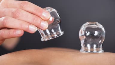 Giác hơi có đau không? Giác hơi nhiều có tốt không?