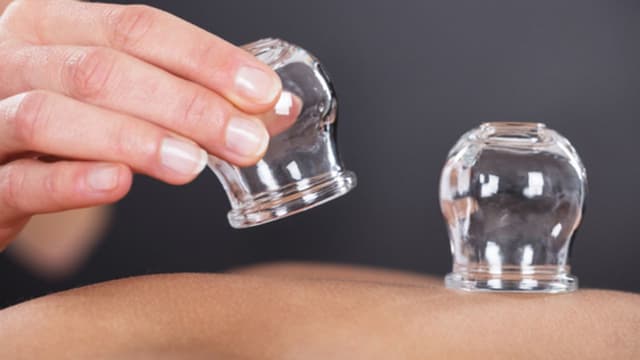 Giác hơi có đau không? Giác hơi nhiều có tốt không?