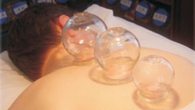 Giác hơi cổ vai gáy có tác dụng gì?