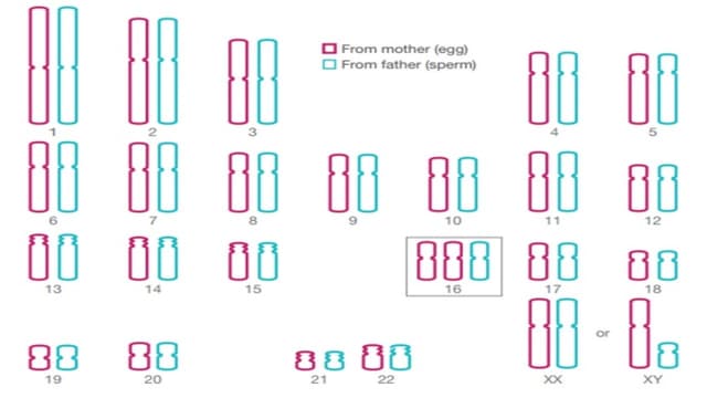 Bất thường nhiễm sắc thể số 20