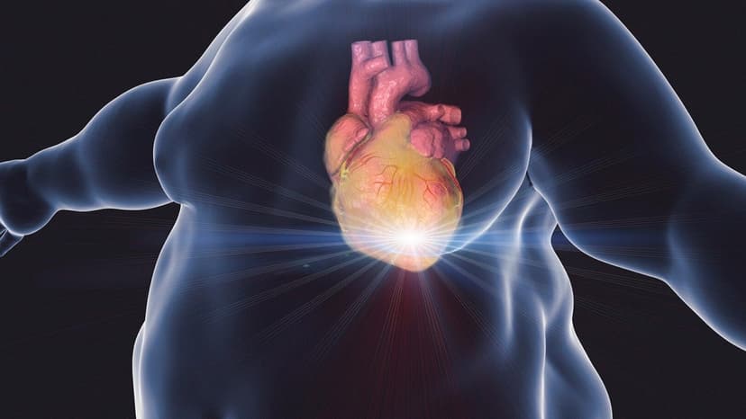 Béo phì có gây đột quỵ không?