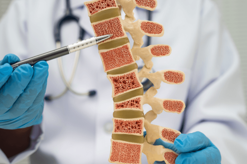 yếu tố nguy cơ loãng xương