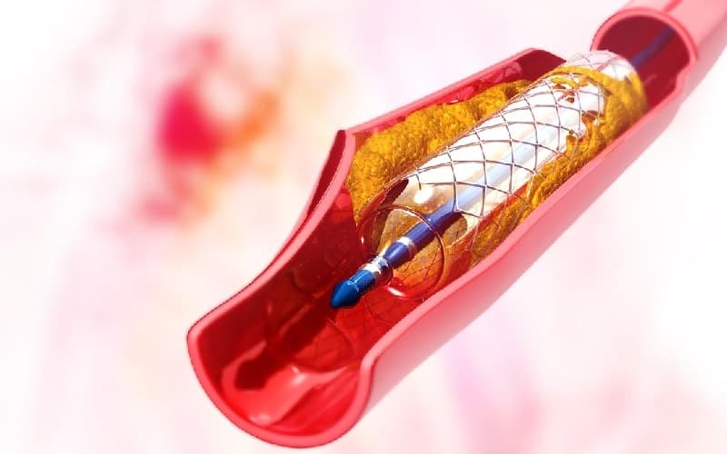 điều trị men tim cao