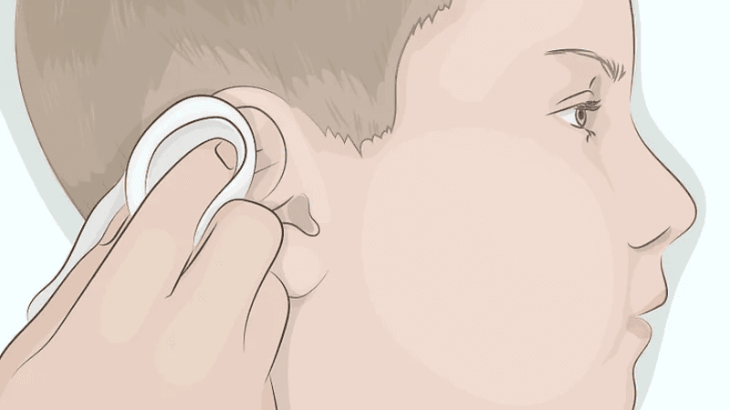 cách vệ sinh lỗ rò luân nhĩ