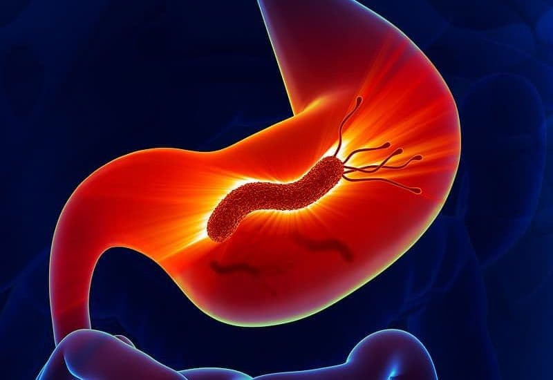 chẩn đoán viêm teo niêm mạc dạ dày