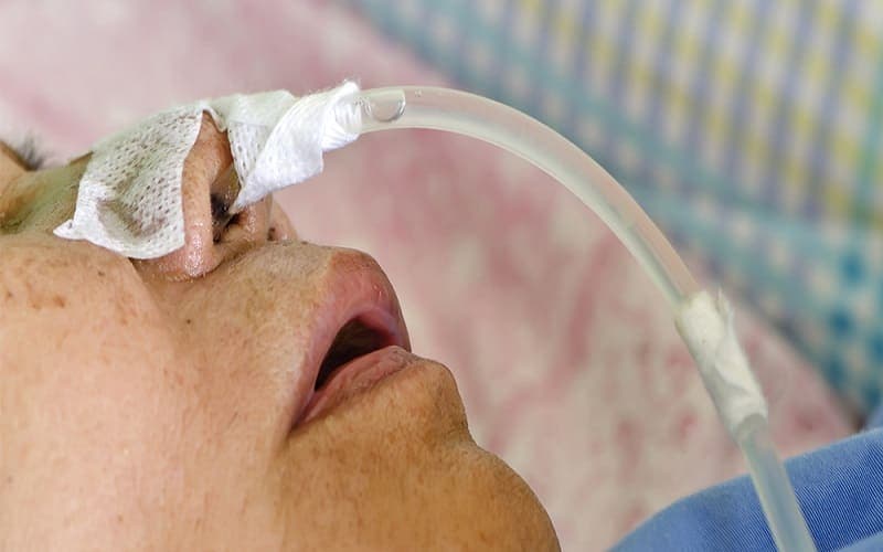 chống chỉ định đặt sonde dạ dày