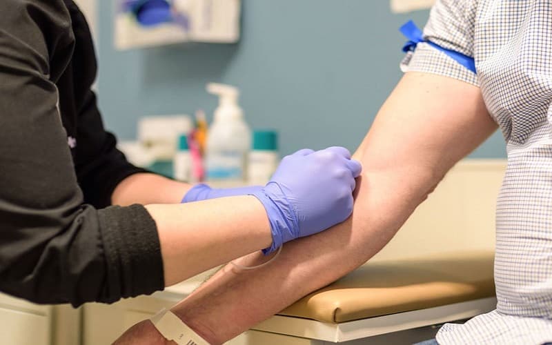 xét nghiệm máu nổi mề đay