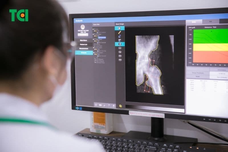 chỉ số loãng xương