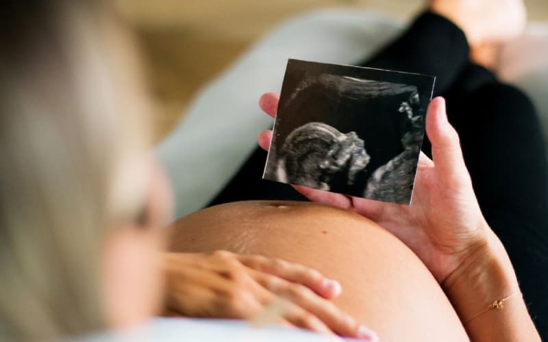 chiều dài xương mũi thai nhi 22 tuần