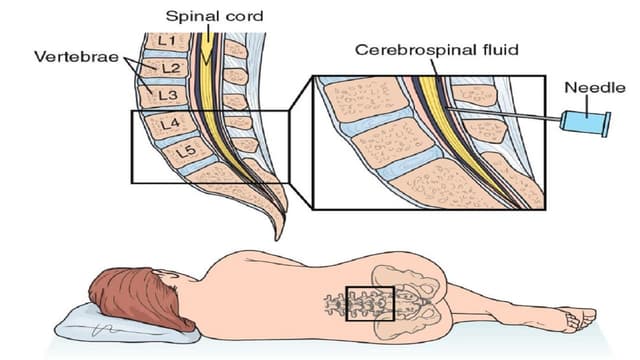 Chống chỉ định chọc dịch não tủy