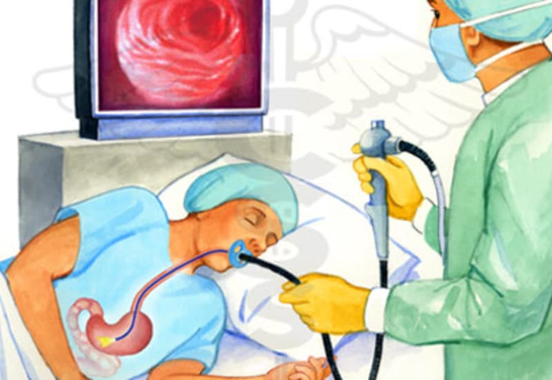 chống chỉ định gây mê